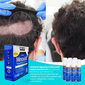 MINOXIDIL KIRKLAND 5% ANTICAIDA Y CRECIMIENTO PARA BARBA Y CABELLO  HOMBRE (ESPUMA Y LIQUIDO)
