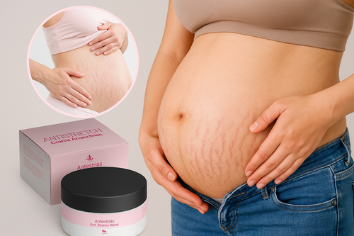 Crema antiestrías para el cuidado corporal